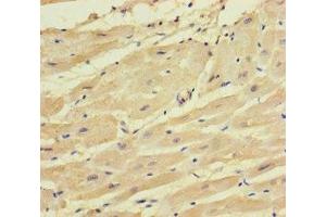 Immunohistochemistry of paraffin-embedded human heart tissue using ABIN7171175 at dilution of 1:100 (SYCN antibody  (AA 22-134))
