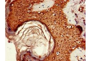 Immunohistochemistry of paraffin-embedded human skin tissue using ABIN7164755 at dilution of 1:100 (PRAS40 antibody  (AA 52-101))