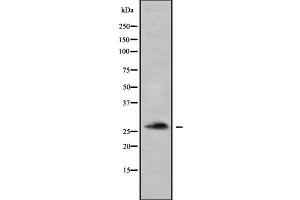 Western blot analysis of CAPNS1 using HeLa whole  lysates. (Calpain S1 antibody  (Internal Region))