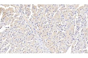 Detection of ITGa11 in Human Cardiac Muscle Tissue using Polyclonal Antibody to Integrin Alpha 11 (ITGa11) (ITGA11 antibody)