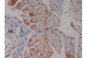 Detection of Flt3 in Mouse Skeletal muscle Tissue using Polyclonal Antibody to FMS Like Tyrosine Kinase 3 (Flt3) (FLT3 antibody  (AA 335-544))