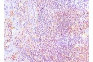 Immunohistochemistry of paraffin-embedded human tonsil tissue using ABIN7158655 at dilution of 1:100 (LSP1 antibody  (AA 1-339))