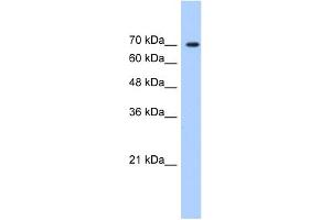 WB Suggested Anti-LAS1L Antibody   Titration: 1.