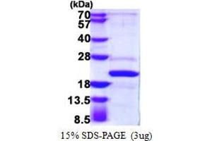 SDS-PAGE (SDS) image for Adaptor-Related Protein Complex 1, sigma 2 Subunit (AP1S2) (AA 1-157) protein (His tag) (ABIN667919) (AP1S2 Protein (AA 1-157) (His tag))