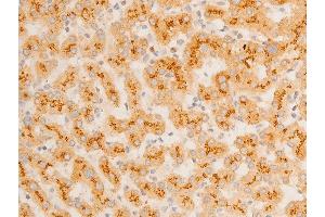 Immunohistochemistry (IHC) image for anti-Nuclear Factor of kappa Light Polypeptide Gene Enhancer in B-Cells Inhibitor, epsilon (NFKBIE) (pSer161) antibody (ABIN6255101)