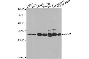 Western blot analysis of extracts of various cell lines, using HNMT antibody (ABIN5971352) at 1/1000 dilution.