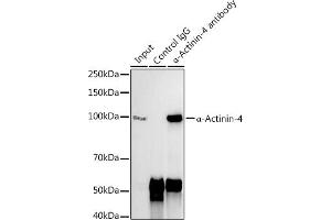 Immunoprecipitation analysis of 300 μg extracts of 293T cells using 3 μg α-Actinin-4 antibody (ABIN7265399). (alpha Actinin 4 antibody)