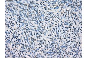 Immunohistochemical staining of paraffin-embedded colon tissue using anti-SLC2A6mouse monoclonal antibody. (SLC2A6 antibody)