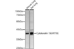 Western blot analysis of extracts of various cell lines, using Cytokeratin 19 (KRT19) antibody (ABIN3020778, ABIN3020779, ABIN3020780 and ABIN6213719) at 1:500 dilution. (Cytokeratin 19 antibody  (AA 241-400))