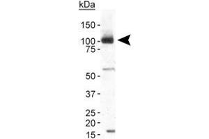 Western blot analysis of TRPA1 in human brain membrane fraction with TRPA1 polyclonal antibody at 2 ug/mL . (TRPA1 antibody  (AA 1-100))