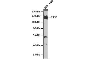 Western blot analysis of extracts of H460 cells, using CAST antibody (ABIN3015047, ABIN3015048, ABIN5663576 and ABIN6213614) at 1:1000 dilution. (Calpastatin antibody  (C-Term))
