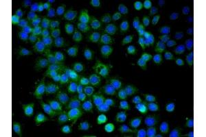 Validation submitted by One World Lab. (ARMC3 antibody  (AA 752-840))