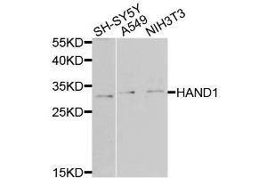 Western blot analysis of extracts of various cell lines, using HAND1 antibody (ABIN6003587) at 1/1000 dilution. (HAND1 antibody)