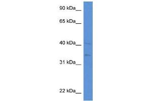 WB Suggested Anti-LIPA AntibodyTitration: 1. (Lipase A antibody  (N-Term))