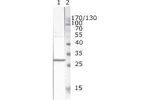 Western Blot testing of HIV-1 recombinant Nef protein. (HIV-1 Nef (AA 171-190) antibody)