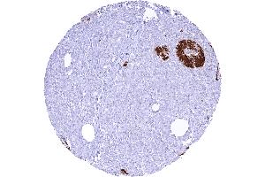 Pancreas with strong cytoplasmic C peptide staining of most islet cells (Recombinant C-Peptide antibody)