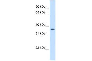 AKR1B10 antibody used at 1. (AKR1B10 antibody)