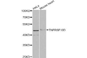 Western blot analysis of extracts of various cell lines, using TNFRSF10D antibody (ABIN5973614) at 1/1000 dilution. (DcR2 antibody)