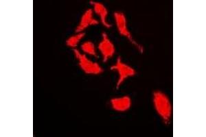 Immunofluorescent analysis of Cullin 4A staining in U2OS cells. (Cullin 4A antibody)