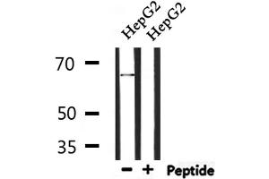 Western blot analysis of extracts from HepG2, using ATIC Antibody. (ATIC antibody  (C-Term))