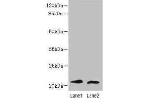 Western blot All lanes: LRRC20 antibody at 1 μg/mL Lane 1: Jurkat whole cell lysate Lane 2: Mouse spleen tissue Secondary Goat polyclonal to rabbit IgG at 1/10000 dilution Predicted band size: 21, 15 kDa Observed band size: 21 kDa