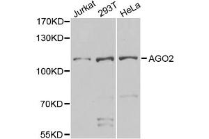 Western blot analysis of extracts of various cell lines, using AGO2 antibody (ABIN5974124) at 1/1000 dilution. (AGO2 antibody)