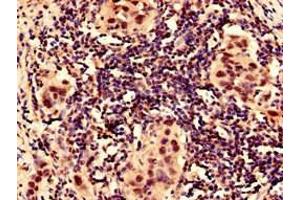 Immunocytochemistry (ICC) image for anti-Hypoxia Inducible Factor 1, alpha Subunit (Basic Helix-Loop-Helix Transcription Factor) (HIF1A) (AA 579-826) antibody (ABIN7156029)