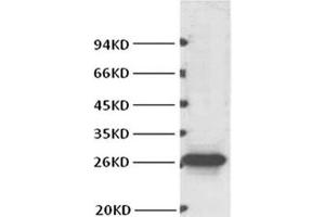 Western Blot analysis of Hela cells using BCL2 Monoclonal Antibody at dilution of 1:1000. (Bcl-2 antibody)