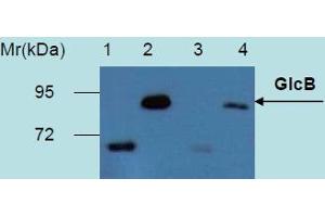 Western Blotting analysis of recombinant protein GlcB produced in Escherichia coli BL21 (lambdaDE3) transfected bacterial culture. (GlcB (M. Tuberculosis) antibody)
