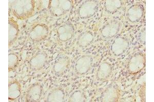 Immunohistochemistry of paraffin-embedded human colon tissue using ABIN7175527 at dilution of 1:100 (VSNL1 antibody  (AA 1-191))