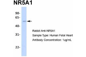 Host:  Rabbit  Target Name:  NR5A1  Sample Type:  Human Fetal Heart  Antibody Dilution:  1. (NR5A1 antibody  (Middle Region))