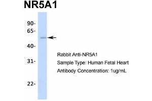 Host:  Rabbit  Target Name:  NR5A1  Sample Type:  Human Fetal Heart  Antibody Dilution:  1.