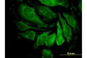 Immunofluorescence of monoclonal antibody to PAK1 on HeLa cell. (PAK1 antibody  (AA 191-280))