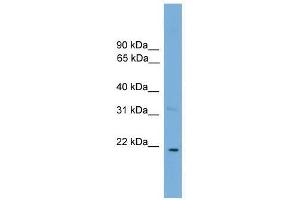 Western Blot showing CTF1 antibody used at a concentration of 1-2 ug/ml to detect its target protein. (Cardiotrophin 1 antibody  (N-Term))