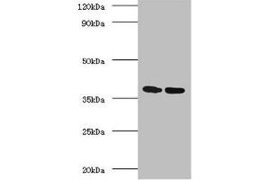 Western blot All lanes: Antigen 85-A antibody at 2 μg/mL Lane 1: Recombinant Mycobacterium tuberculosis Antigen 85-A protein 1 μg Lane 2: Recombinant Mycobacterium tuberculosis Antigen 85-A protein 10 μg Secondary Goat polyclonal to rabbit IgG at 1/10000 dilution Predicted band size: 36 kDa Observed band size: 36 kDa (FBPA (AA 53-331) antibody)