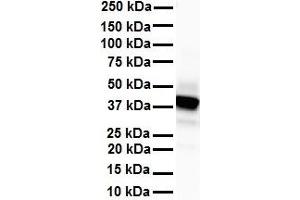 WB Suggested Anti-SLC6A5 antibody Titration: 1 ug/mL Sample Type: Human heart