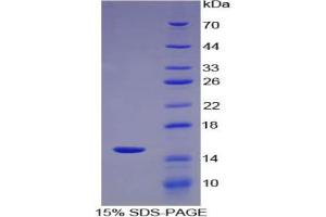 SDS-PAGE analysis of Mouse PLA2G2D Protein. (PLA2G2D Protein)
