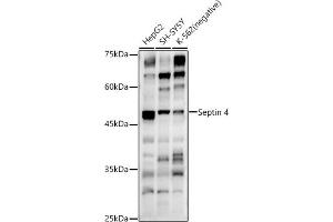 Western blot analysis of extracts of various cell lines, using Septin 4 antibody (ABIN6128476, ABIN6147554, ABIN6147555 and ABIN6214410) at 1:500 dilution. (Septin 4 antibody  (AA 1-100))
