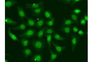 Immunofluorescence analysis of A549 cells using XPA antibody. (XPA antibody)