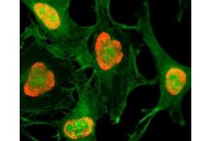 ICC testing of HeLa cells treated with sodium butyrate using recombinant H3K79ac antibody (red).
