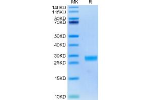 Cynomolgus IL-6 on Tris-Bis PAGE under reduced condition. (IL-6 Protein (AA 28-212) (His tag))
