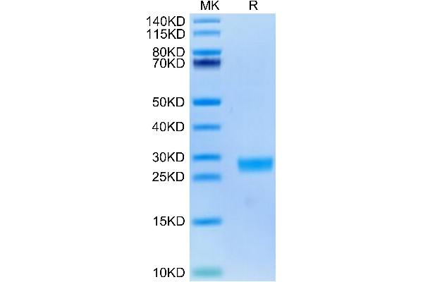 IL-6 Protein (AA 28-212) (His tag)