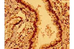 Immunohistochemistry of paraffin-embedded human lung tissue using ABIN7151731 at dilution of 1:100 (ECSCR antibody  (AA 25-124))
