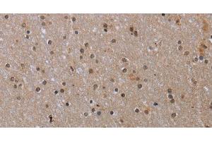 Immunohistochemistry of paraffin-embedded Human brain tissue using MED12 Polyclonal Antibody at dilution 1:40 (MED12 antibody)