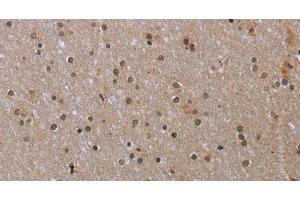 Immunohistochemistry of paraffin-embedded Human brain tissue using MED12 Polyclonal Antibody at dilution 1:40