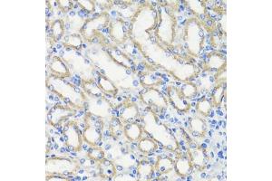 Immunohistochemistry of paraffin-embedded mouse kidney using DEPDC6 antibody (ABIN7266738) at dilution of 1:200 (40x lens). (DEPTOR antibody  (AA 1-220))