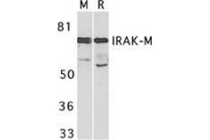 Western blot analysis of IRAK-M in mouse spleen (M) and rat liver (R) tissue lysates with AP30443PU-N IRAK-M antibody at 1 μg/ml. (IRAK3 antibody)