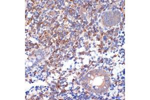Immunohistochemistry of paraffin-embedded human appendix using V Rabbit mAb (ABIN7271304) at dilution of 1:100 (40x lens). (VAV2 antibody)