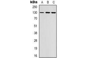 Western blot analysis of EPHB1/2 expression in K562 (A), NIH3T3 (B), HEK293T (C) whole cell lysates. (EPHB1/2 antibody)