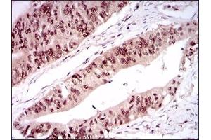 anti-One Cut Homeobox 3 (ONECUT3) (AA 350-455) antibody